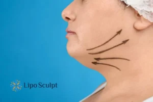 Boost your confidence with a Double chin treatment Croydon 