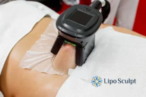 Cryolipolysis Helping You Getting that Perfect Summer Body 3 Cryolipolysis Croydon can give you the best summer body - contact us today!