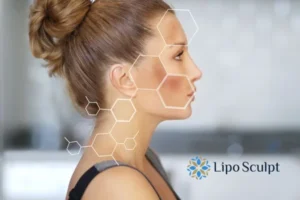 Are you looking at age spots Croydon removal? Contact Lipo Sculpt today!