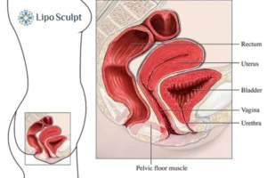 How EM Chair treatment Croydon can help Leaky bladder issues. Read more now!