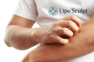 prevent your actinic keratoses Croydon getting worse - call our team today!