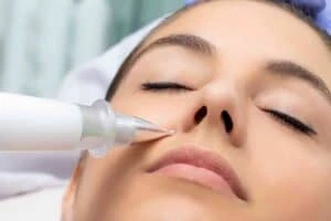 Actinic keratoses Croydon solutions - book in today!